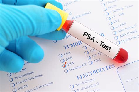 psa blood test near me.